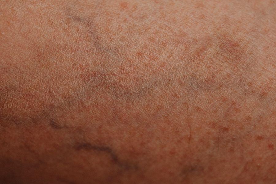 Câmara de análise facial com inteligência artificial
