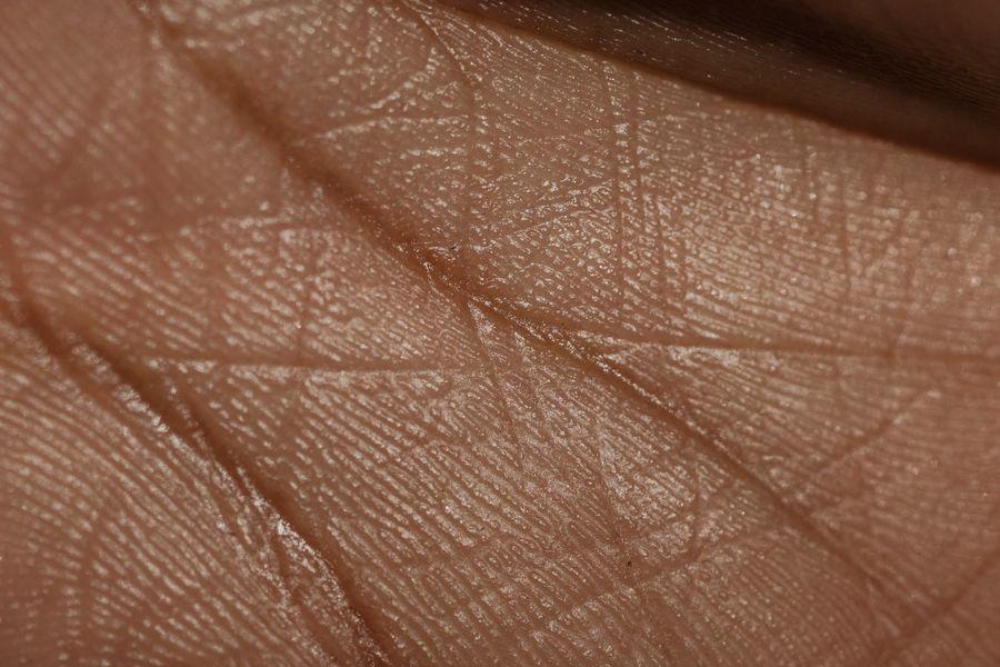 Dispositivo de ultrassom facial aplicado no rosto
